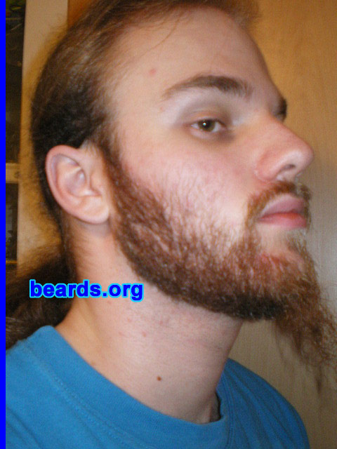 Michael
2008 growth series: day 35

[b]Go to [url=http://www.beards.org/michael.php]Michael's success story[/url][/b].
Keywords: michael_2008_series.1 full_beard