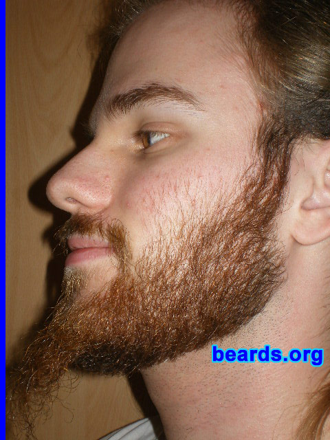 Michael
2008 growth series: day 42

[b]Go to [url=http://www.beards.org/michael.php]Michael's success story[/url][/b].
Keywords: michael_2008_series.1 full_beard