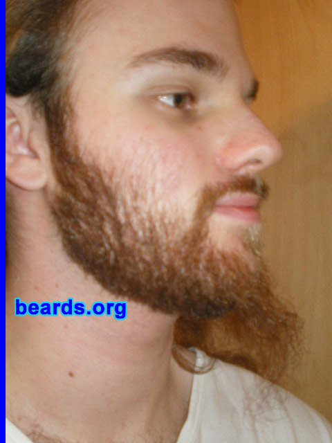 Michael
2008 growth series: day 42

[b]Go to [url=http://www.beards.org/michael.php]Michael's success story[/url][/b].
Keywords: michael_2008_series.1 full_beard