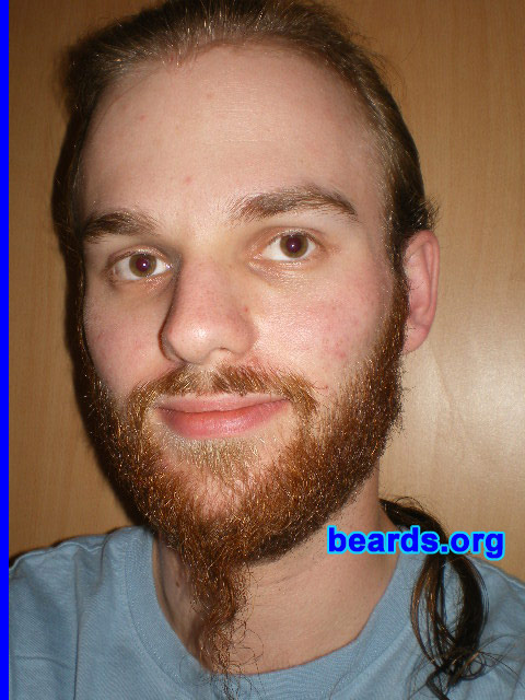 Michael
2008 growth series: day 49

[b]Go to [url=http://www.beards.org/michael.php]Michael's success story[/url][/b].
Keywords: michael_2008_series.1 full_beard