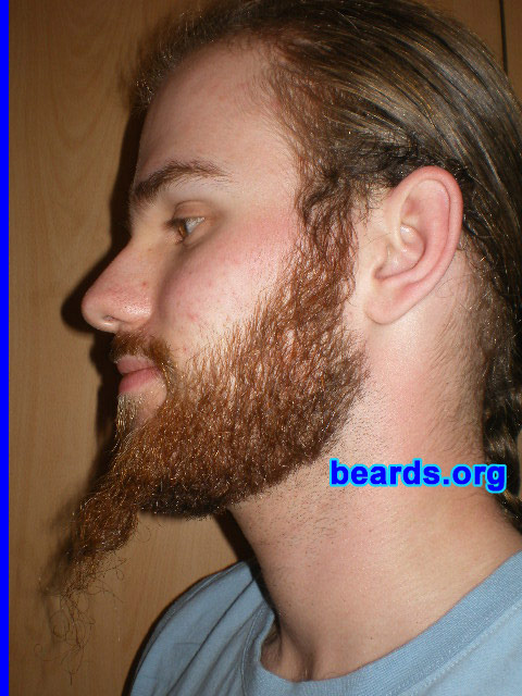 Michael
2008 growth series: day 49

[b]Go to [url=http://www.beards.org/michael.php]Michael's success story[/url][/b].
Keywords: michael_2008_series.1 full_beard