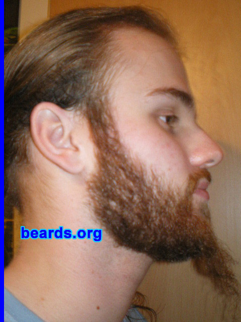 Michael
2008 growth series: day 49

[b]Go to [url=http://www.beards.org/michael.php]Michael's success story[/url][/b].
Keywords: michael_2008_series.1 full_beard