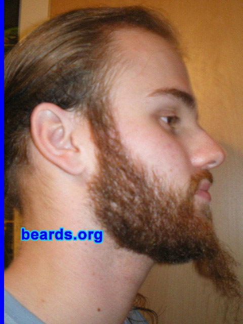 Michael
2008 growth series: day 49

[b]Go to [url=http://www.beards.org/michael.php]Michael's success story[/url][/b].
Keywords: michael_2008_series.1 full_beard