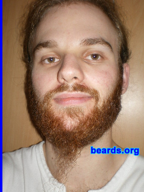 Michael
2008 growth series: day 63

[b]Go to [url=http://www.beards.org/michael.php]Michael's success story[/url][/b].
Keywords: michael_2008_series.1 full_beard