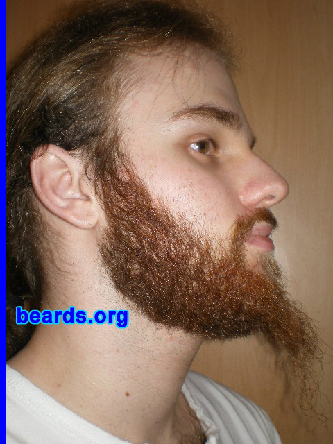 Michael
2008 growth series: day 63

[b]Go to [url=http://www.beards.org/michael.php]Michael's success story[/url][/b].
Keywords: michael_2008_series.1 full_beard