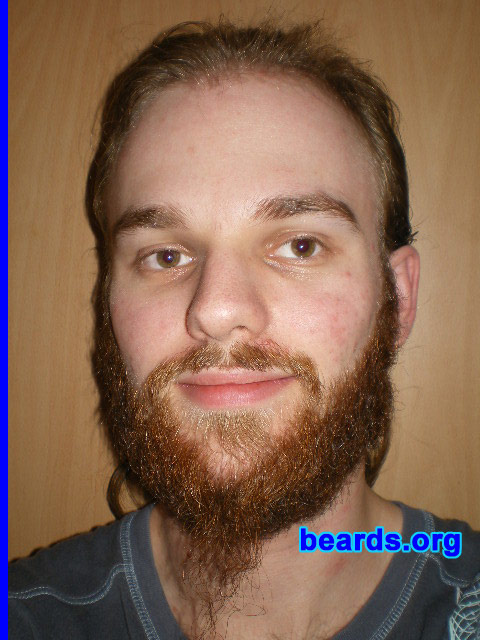 Michael
2008 growth series: day 77

[b]Go to [url=http://www.beards.org/michael.php]Michael's success story[/url][/b].
Keywords: michael_2008_series.1 full_beard