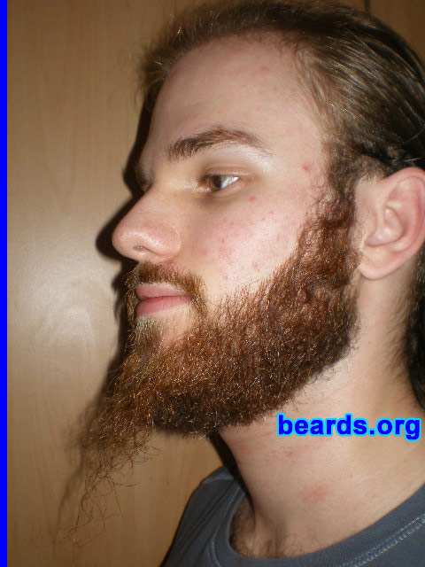 Michael
2008 growth series: day 77

[b]Go to [url=http://www.beards.org/michael.php]Michael's success story[/url][/b].
Keywords: michael_2008_series.1 full_beard