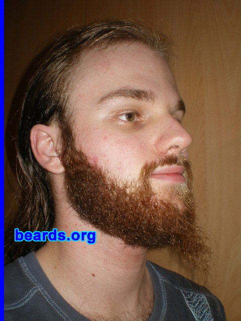 Michael
2008 growth series: day 77

[b]Go to [url=http://www.beards.org/michael.php]Michael's success story[/url][/b].
Keywords: michael_2008_series.1 full_beard