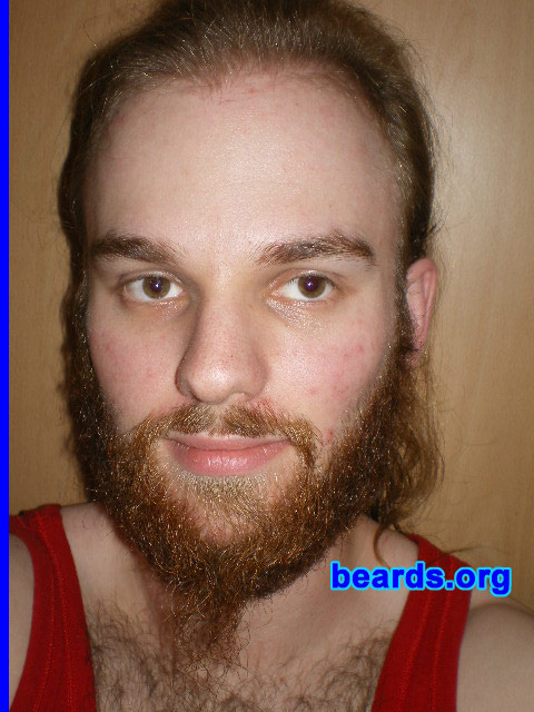 Michael
2008 growth series: day 84

[b]Go to [url=http://www.beards.org/michael.php]Michael's success story[/url][/b].
Keywords: michael_2008_series.1 full_beard