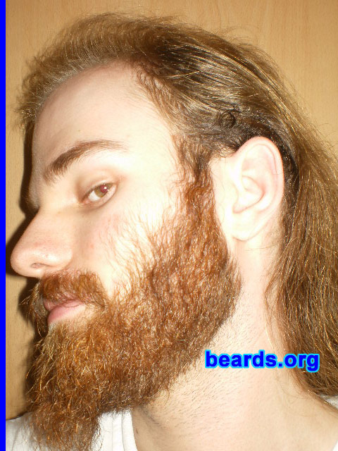 Michael
October 2009 update

[b]Go to [url=http://www.beards.org/michael.php]Michael's success story[/url][/b].
Keywords: michael_2009_October.1 full_beard