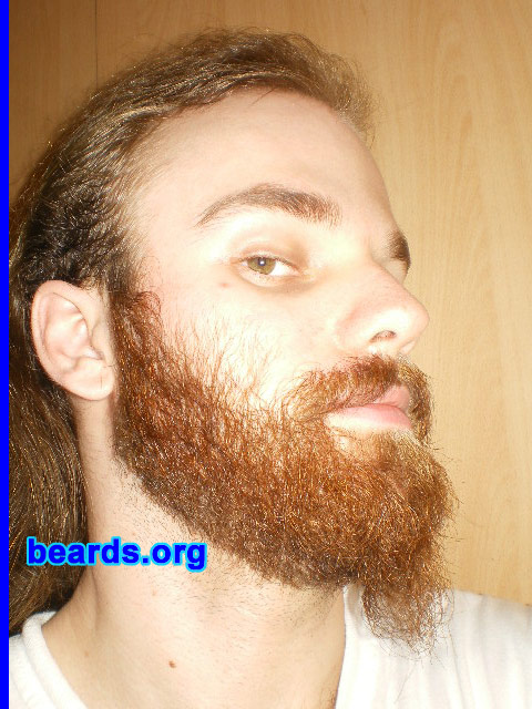 Michael
October 2009 update

[b]Go to [url=http://www.beards.org/michael.php]Michael's success story[/url][/b].
Keywords: michael_2009_October.1 full_beard