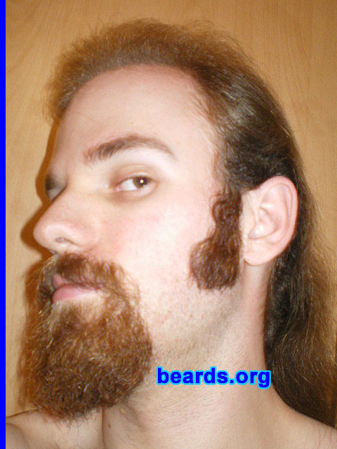Michael
January 2010 update

[b]Go to [url=http://www.beards.org/michael.php]Michael's success story[/url][/b].
Keywords: goatee_mustache