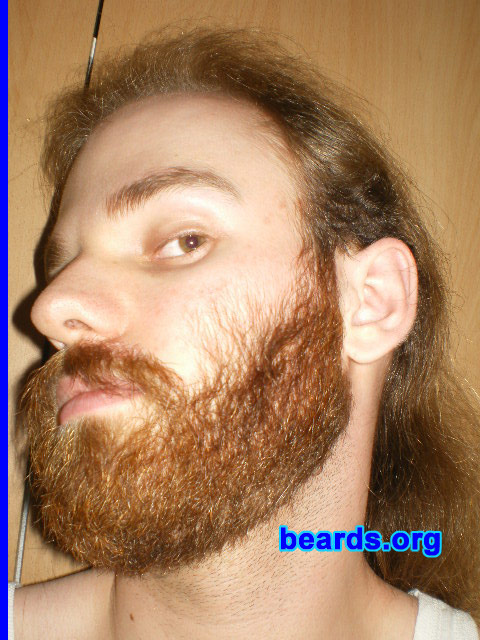 Michael
July 2010

[b]Go to [url=http://www.beards.org/michael.php]Michael's success story[/url][/b].
Keywords: michael2011.1 full_beard