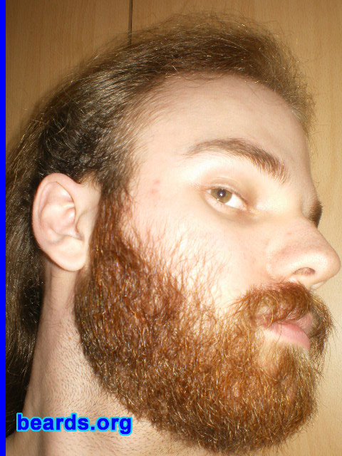Michael
July 2010

[b]Go to [url=http://www.beards.org/michael.php]Michael's success story[/url][/b].
Keywords: michael2011.1 full_beard