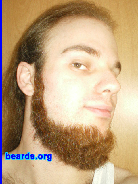 Michael
November 2010

[b]Go to [url=http://www.beards.org/michael.php]Michael's success story[/url][/b].
Keywords: michael2011.1 chin_curtain