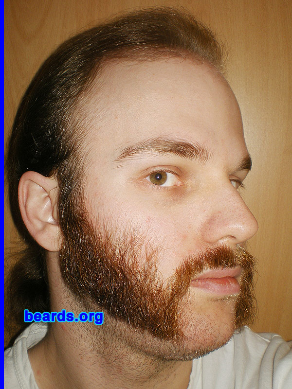 Michael
December 2011 Friendly Mutton Chops

[b]Go to [url=http://www.beards.org/michael.php]Michael's success story[/url][/b].
Keywords: mutton_chops