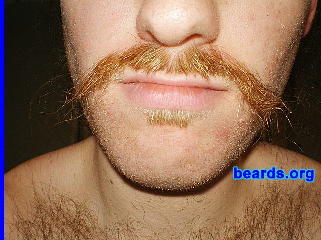 Michael
February 2012

[b]Go to [url=http://www.beards.org/michael.php]Michael's success story[/url][/b].
Keywords: mustache soul_patch