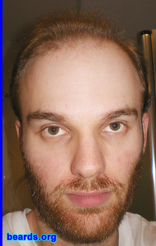 Michael
full beard 2012 growth progress: week three

[b]Go to [url=http://www.beards.org/michael.php]Michael's success story[/url][/b].
Keywords: Michael.2012.full full_beard