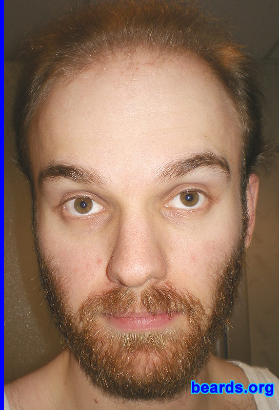 Michael
full beard 2012 growth progress: week five

[b]Go to [url=http://www.beards.org/michael.php]Michael's success story[/url][/b].
Keywords: Michael.2012.full full_beard