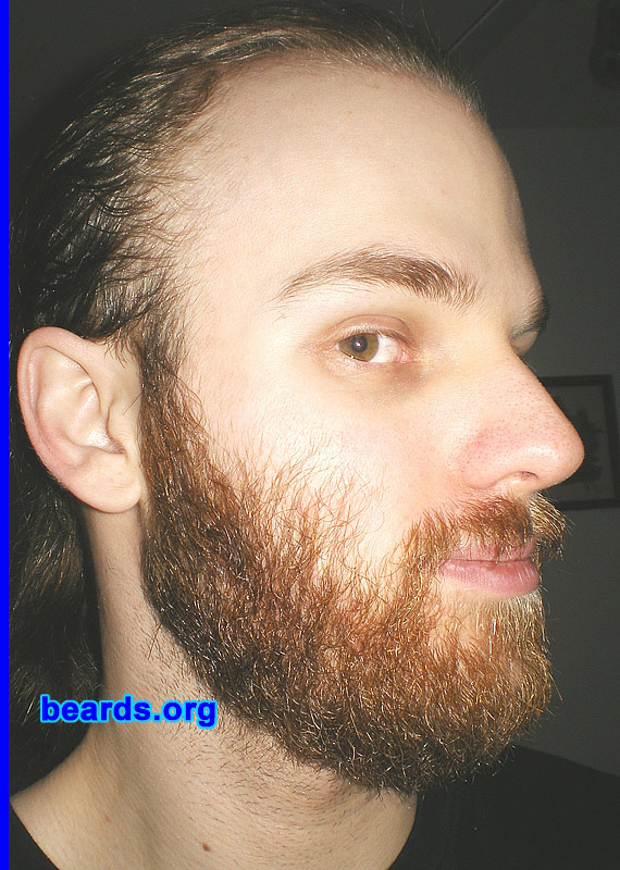 Michael
full beard 2012 growth progress: week eight

[b]Go to [url=http://www.beards.org/michael.php]Michael's success story[/url][/b].
Keywords: Michael.2012.full full_beard