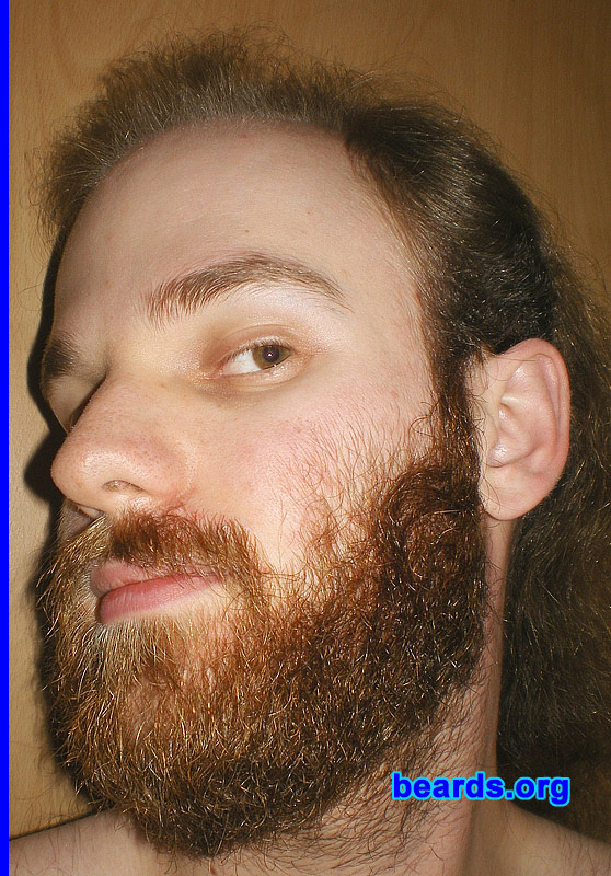 Michael
full beard 2012 growth progress: week twelve

[b]Go to [url=http://www.beards.org/michael.php]Michael's success story[/url][/b].
Keywords: Michael.2012.full full_beard