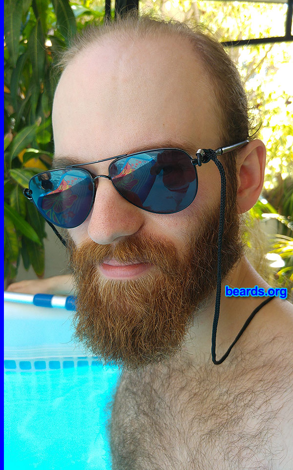 Michael
full beard 2015

[b]Go to [url=http://www.beards.org/michael.php]Michael's success story[/url][/b].
Keywords: Michael.2015.2.full full_beard