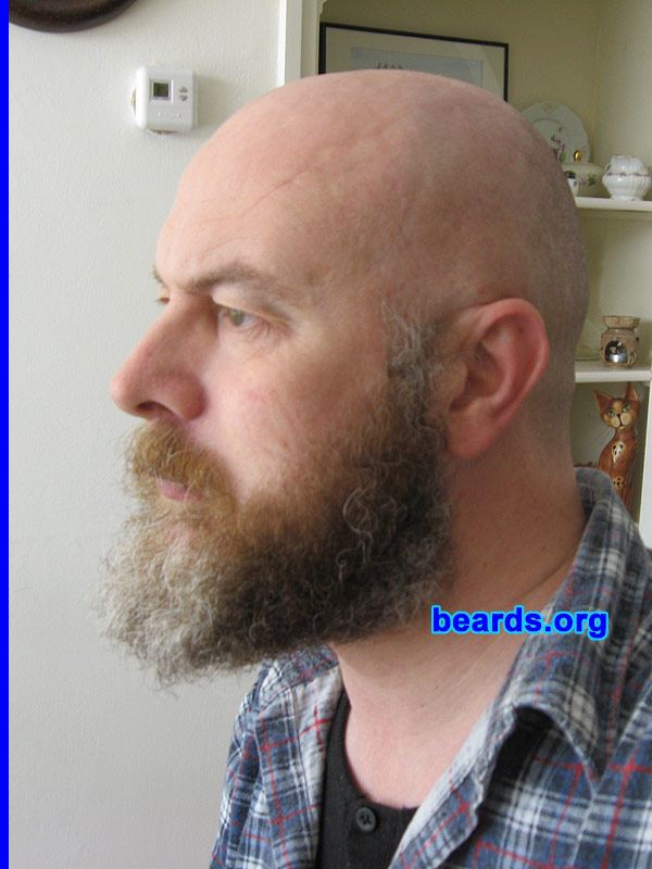 PP Van der Sluis
Bearded since: 2006.  I am a dedicated, permanent beard grower.

Comments:
I grew my beard because I hate shaving and like beards.

How do I feel about my beard?  I am loving it.  It feels great!!!!!!!!!!!
Keywords: full_beard