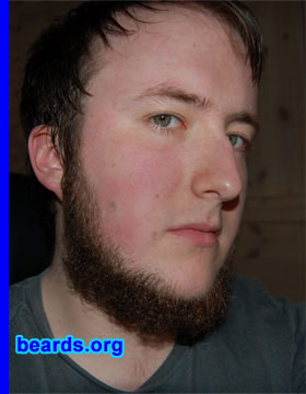 Jostein T.
Bearded since: 2000.  I am a dedicated, permanent beard grower.

Comments:
I grew my beard because a beard makes you wise! 

How do I feel about my beard?  Could be better, could be worse.   ;) 
More or less satisfied.
Keywords: chin_curtain