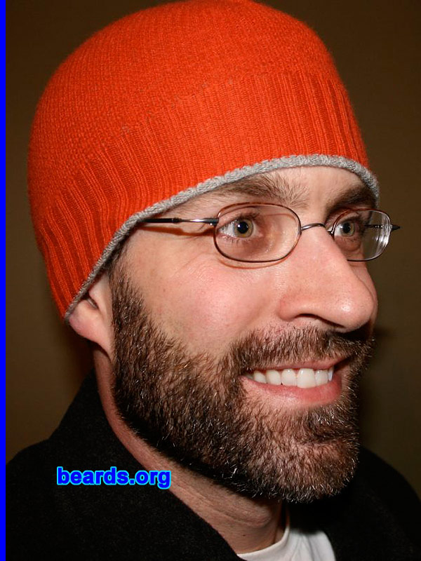 Patrick
Patrick's beard growth progress: Day 20.

[b]Go to [url=http://www.beards.org/patrick.php]Patrick's success story[/url][/b].
Keywords: patrick full_beard