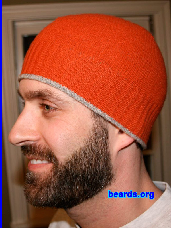 Patrick
Patrick's beard growth progress: Day 25.

[b]Go to [url=http://www.beards.org/patrick.php]Patrick's success story[/url][/b].
Keywords: patrick full_beard