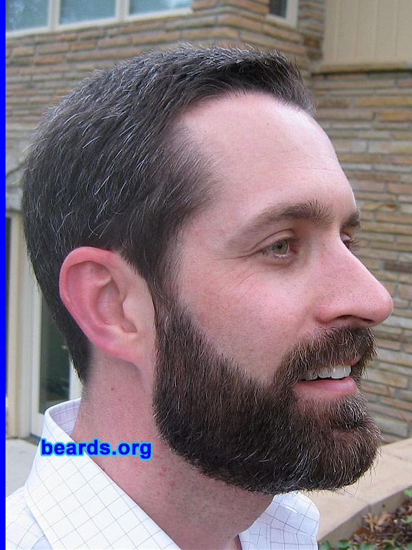 Patrick
Patrick's beard growth progress: Day 65 after the first trim.

[b]Go to [url=http://www.beards.org/patrick.php]Patrick's success story[/url][/b].
Keywords: patrick full_beard