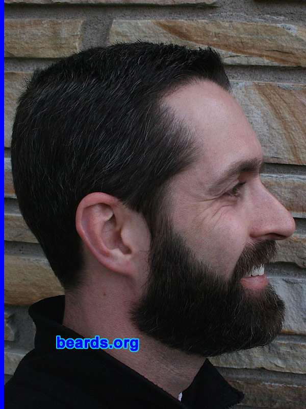 Patrick
Patrick's neck line adjustment: [b]before[/b].
Also see Patrick's neck line adjustment: [url=http://www.beards.org/images/displayimage.php?pos=-1919][b]after[/b][/url].

[b]Go to [url=http://www.beards.org/patrick.php]Patrick's success story[/url][/b].
Keywords: patrick full_beard