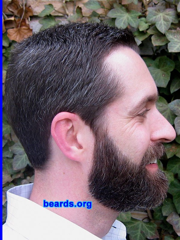 Patrick
Patrick's neck line adjustment: [b]after[/b].
Also see Patrick's neck line adjustment: [url=http://www.beards.org/images/displayimage.php?pos=-1920][b]before[/b][/url].

[b]Go to [url=http://www.beards.org/patrick.php]Patrick's success story[/url][/b].
Keywords: patrick full_beard