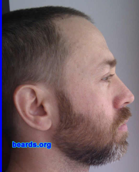 Amedeo
Bearded since: 2006. I am a dedicated, permanent beard grower.

Comments:
I grew my beard because it makes me more confident and feel very well in my "bearded" skin. :)

How do I feel about my beard? I'm really proud of my beard! :)
Keywords: full_beard