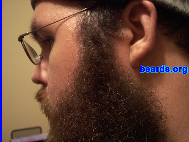 Shaun
[b]Go to [url=http://www.beards.org/shaun.php]Shaun's success story[/url][/b].
Keywords: full_beard