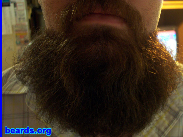 Shaun
[b]Go to [url=http://www.beards.org/shaun.php]Shaun's success story[/url][/b].
Keywords: goatee_mustache