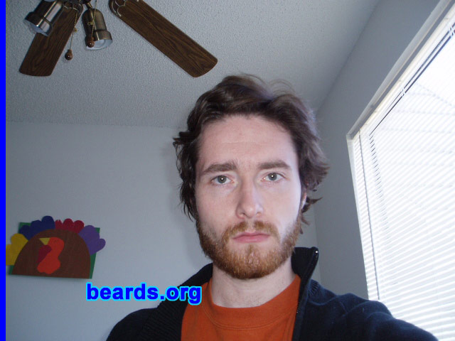Stewart
Beard growth progresses.

[b]Go to [url=http://www.beards.org/stewart.php]Stewart's success story[/url][/b].
Keywords: full_beard