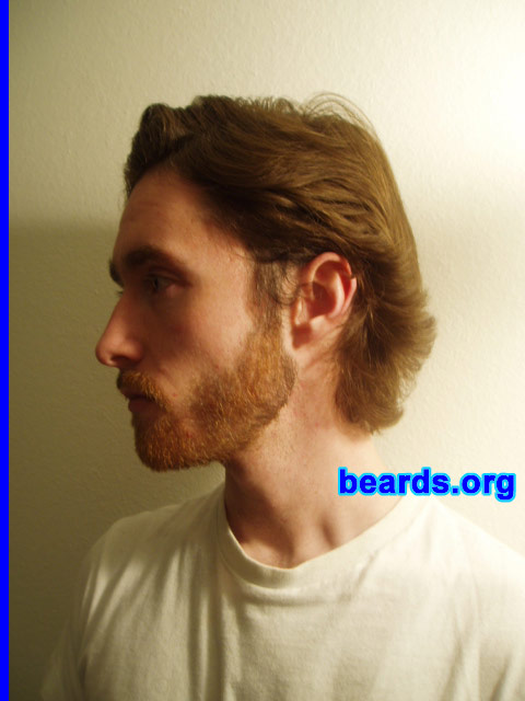 Stewart
Steward's beard growth shows further progress.

[b]Go to [url=http://www.beards.org/stewart.php]Stewart's success story[/url][/b].
Keywords: full_beard