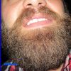 beard046014.jpg