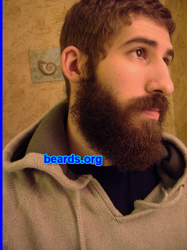 Tim
[b]Go to [url=http://www.beards.org/success_tim.php]Tim's success story[/url][/b].
Keywords: full_beard