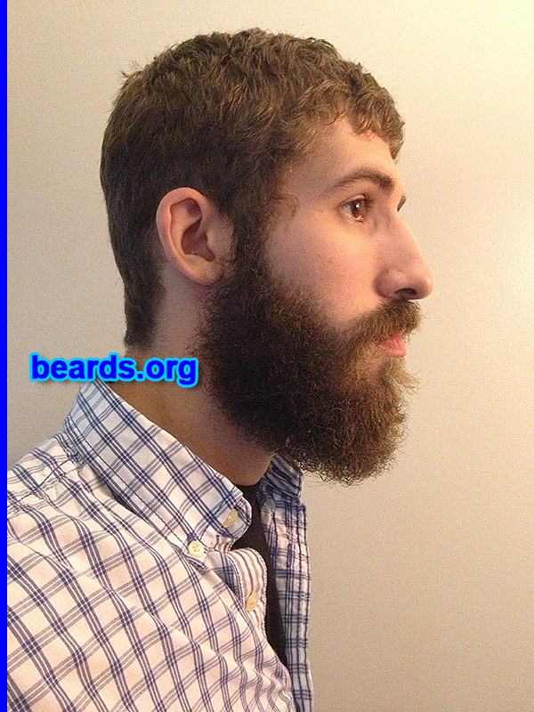 Tim
[b]Go to [url=http://www.beards.org/success_tim.php]Tim's success story[/url][/b].
Keywords: full_beard