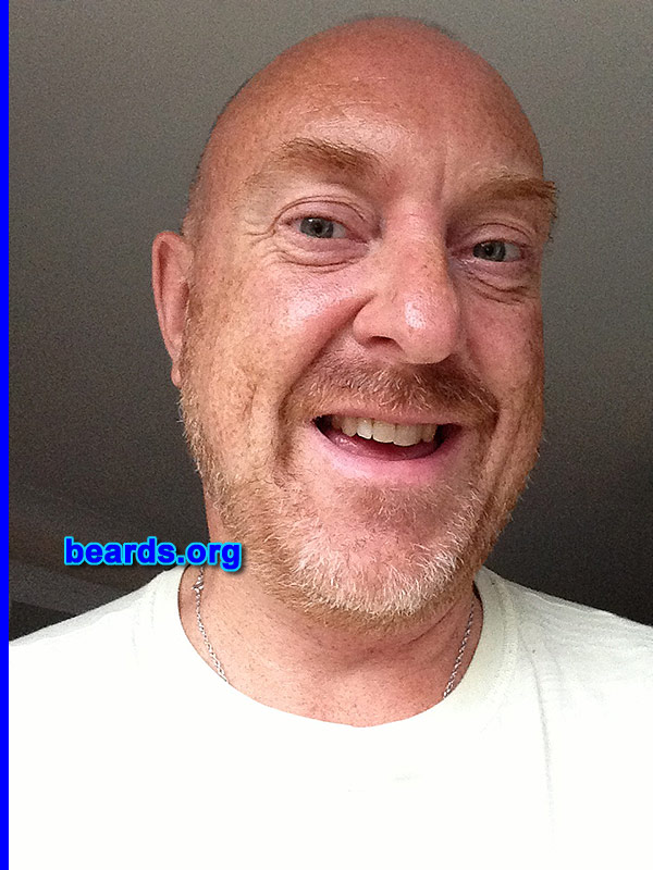 Clive B.
Bearded since: 2003. I am a dedicated, permanent beard grower.

Comments:
Why did I grow my beard? Because I wanted to see what I would look like with a ginger beard.

How do I feel about my beard? I which it were thicker.
Keywords: full_beard