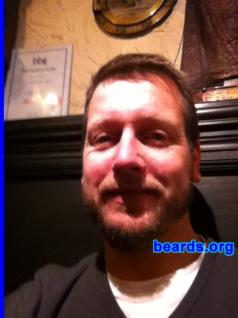 Damo
Bearded since: 2011. I am an occasional or seasonal beard grower.

Comments:
Why did I grow my beard? Experimental purposes.

How do I feel about my beard? Could be thicker, but restricted by genetics. Otherwise awesome.
Keywords: full_beard