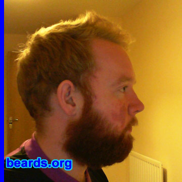 Frankie B.
Bearded since: 2011. I am an experimental beard grower.

Comments:
I have always had the urge to grow my beard but either people, jobs, or even family got me to shave it off. I'm now in a job where I can do what I want and have more of a focus on growing it now that I ever did! Also, being Scottish I was influenced by big Hamish out of Braveheart! Haha!

How do I feel about my beard? I like it.  At times I struggle as to whether I should keep it or not. If it weren't for a weak mustache I'd grow it for years. Also, I have a bit of a birth mark on my right cheek which I think affects (on that side) how high my cheek-line growth is. All in all, I'm happy with it for the moment. Just waiting on the mustache to catch up! :)
Keywords: full_beard