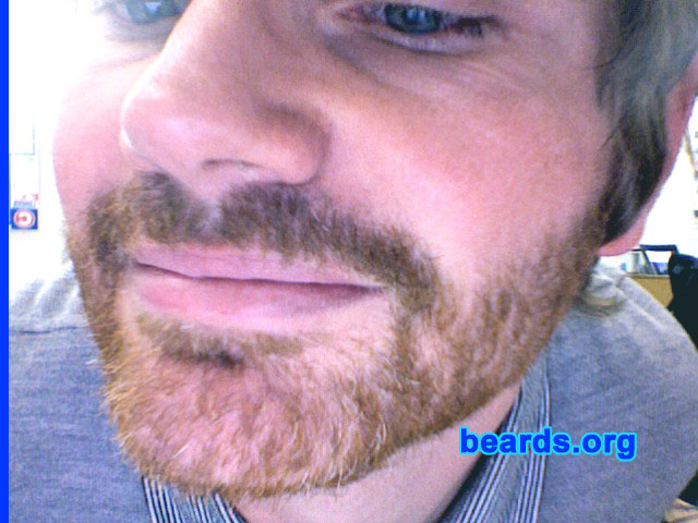 Matthew Taylor
Bearded since: 2008.  I am an experimental beard grower.

Comments:
I grew my beard because rumour has it the chicks love them.

How do I feel about my beard?  So far, so gooooood.
Keywords: full_beard