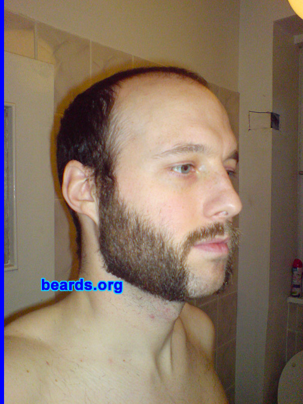 Neil
Bearded since: 2001.  I am an experimental beard grower.

Comments:
I suffer from male pattern baldness and hence find the fact of growing a beard of any type both fun and a welcome distraction to the lack of hair on my head.

How do I feel about my beard?  I am very pleased with my own beard but have slight reservations about the wispiness of my mustache in comparison to the rest of my beard growth, which is much darker and thicker.
Keywords: mutton_chops