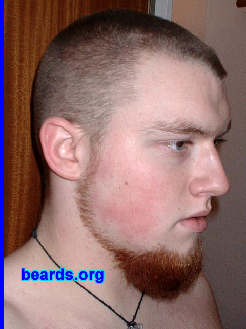 Richard Draper
Bearded since: 2005.  I am a dedicated, permanent beard grower.

Comments:
I grew my beard because I always wanted a beard and my fiancee likes it too!

How do I feel about my beard?  I like it.  I want to grow it longer!
Keywords: chin_curtain