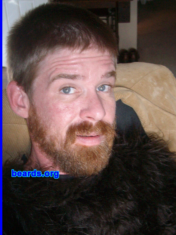 Matt
Bearded since: 2009. I am a dedicated, permanent beard grower.

Comments:
I grew my beard because it is AWESOME!

How do I feel about m y beard? Super duper!
Keywords: full_beard