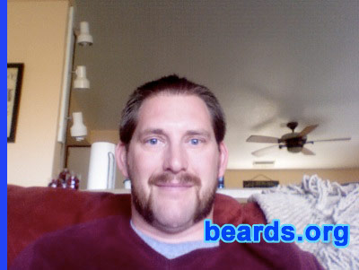 Matt
Bearded since: 2011. I am an occasional or seasonal beard grower.

Comments:
I grew my beard for a play.

How do i feel about my beard? Like it.
Keywords: mutton_chops