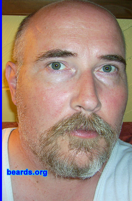 Jack
Bearded since: 2005.  I am a dedicated, permanent beard grower.

Comments:
I grew my beard because I like that it gives me a distinguished look.  And since my hairline has receded, a beard helps to balance my face.

How do I feel about my beard? I love it; I have convinced myself that it gives me a Sean Connery sort of look...please don't shatter my illusions!
Keywords: goatee_mustache